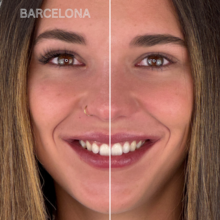 Vergleichsbild eines Gesichts: linke Seite mit dem Barcelona-Magnetwimpern-Stil für einen voluminösen Cat-Eye-Look mit ausdrucksstarkem Schwung – perfekt für einen offenen, gelifteten Blick. Rechte Seite ohne Magnetwimpern. Die ideale Wahl für einen dramatischen, aber dennoch natürlichen Augenaufschlag mit veganen, wiederverwendbaren Wimpern.