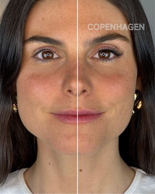 Vergleichsbild eines Gesichts: linke Seite mit dem Copenhagen-Magnetwimpern-Stil für einen natürlichen Cat-Eye-Look mit sanftem Schwung – ideal für einen subtilen Lifting-Effekt und einen eleganten, alltagstauglichen Augenaufschlag. Rechte Seite ohne Magnetwimpern. Perfekt für einen dezenten, aber betonten Blick mit veganen, wiederverwendbaren Wimpern.